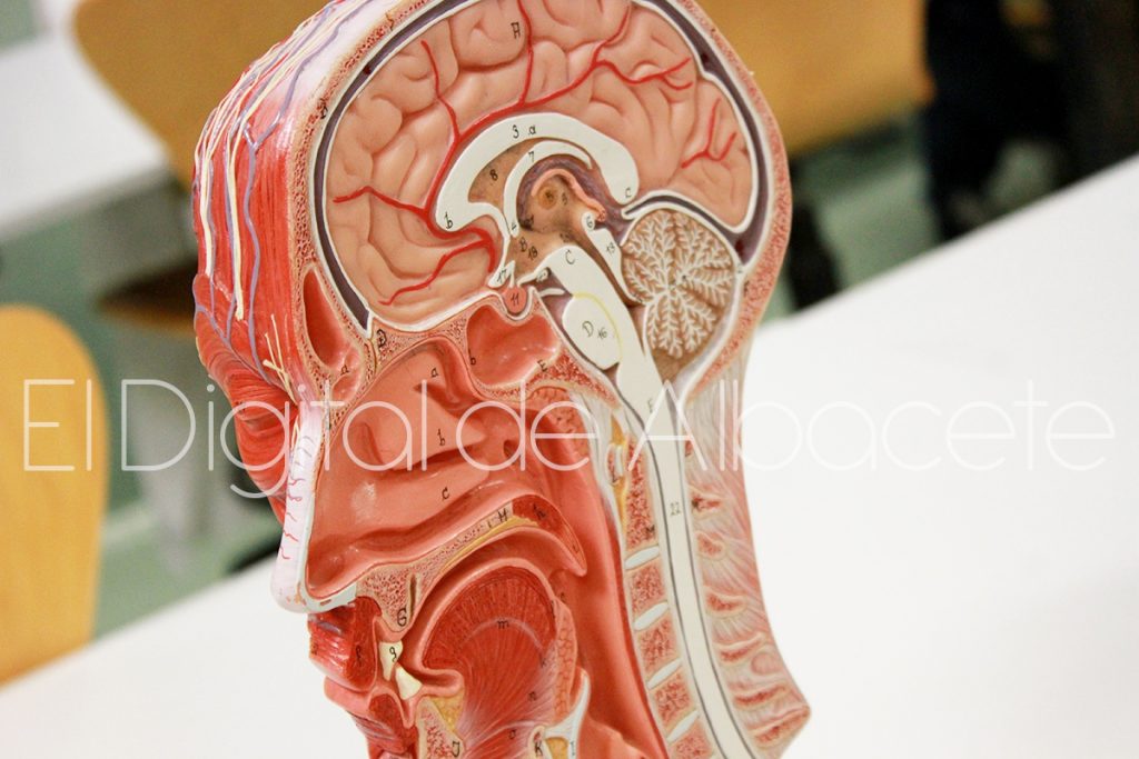 ¿Qué Consecuencias Tiene La Trombosis De Senos Venosos Cerebrales? - El ...